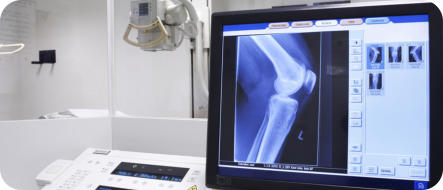 Photo of knee x-rays being displayed on a computer screen with medical equipment behind it.