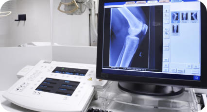 Photo of knee x-rays being displayed on a computer screen with medical equipment behind it.