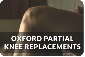 Oxford Partial Knee Replacements
